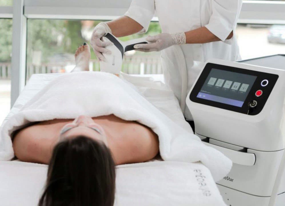 Laser-Haarentfernung am Bein mit dem MeDioStar® Diodenlaser